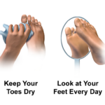 Foot Care with Jo the Podiatrist