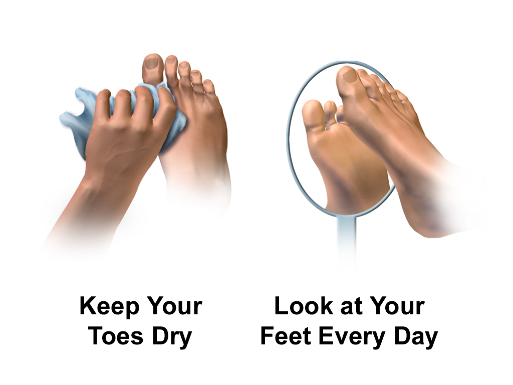 Foot Care with Jo the Podiatrist